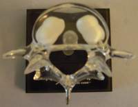 Acryl-Modell eines Wirbelknochens